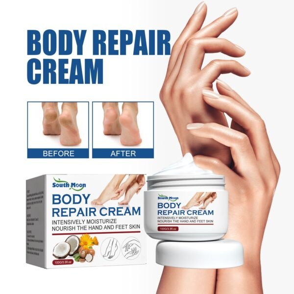 Body Repair Cream, Relieve Peeling Improve Chapped Dry Skin And Remove Dead Skin Moisturize Cream