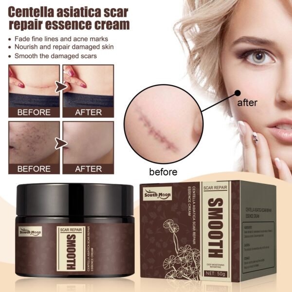 Centella Asiatica Scar Repair Essence Cream, Fade Scars Moisturizing Smooth Firming Skin Repair cream