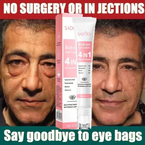 Eye Bag and Dark Circle Removal