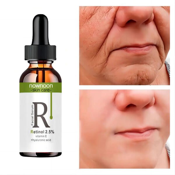 Retinol Anti Wrinkle Dark Spot Removal.